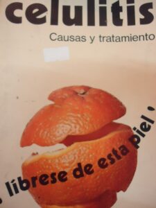 Portada CELULITIS. CAUSAS Y TRATAMIENTO - VVAA - DAIMON